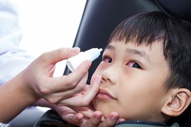 5 Dấu hiệu trẻ bị đau mắt đỏ cần đi khám ngay